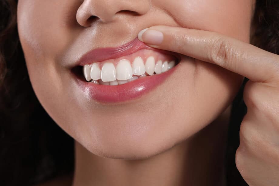 How to Prevent Gum Recession: Tips for Healthy Gums